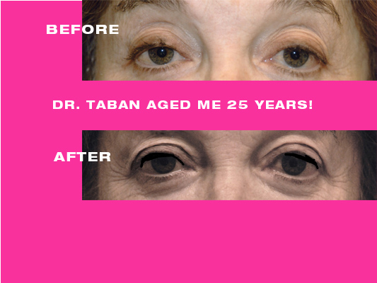 Dr. Taban AGED ME 25 YEARS!