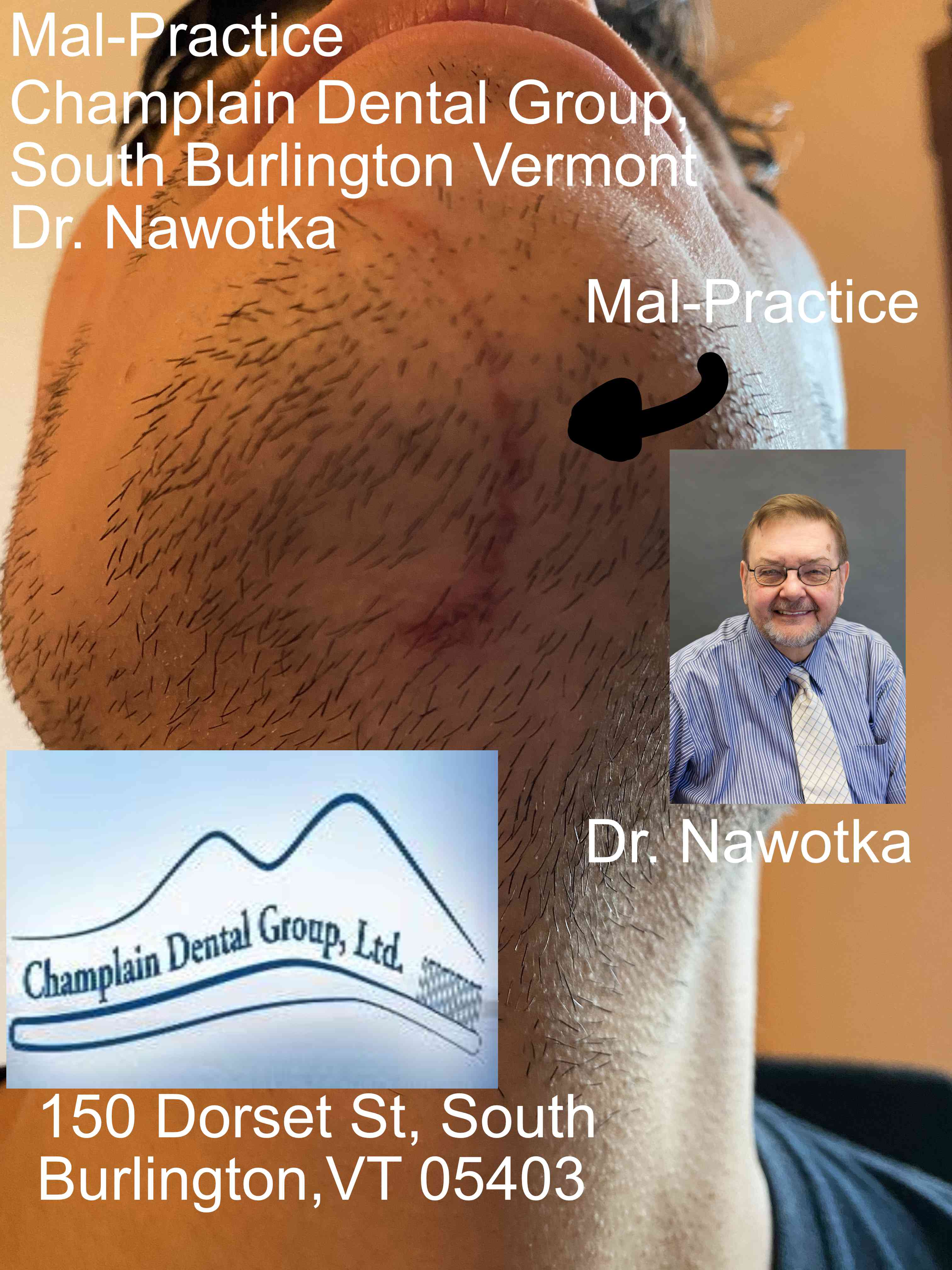 Mal-Practice! Dr. Nawotka Champlain Dental South B