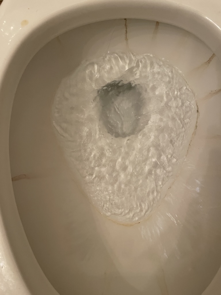 toilet stain cannot be removed